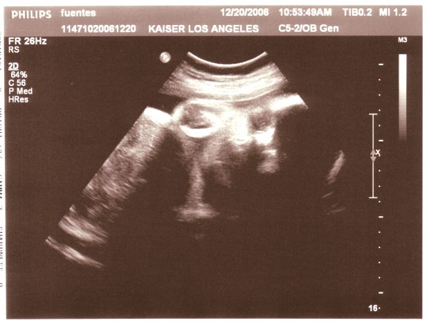 2006_12_20a_ultrasound