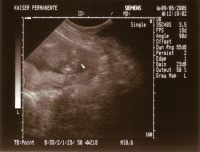 Boy or Girl?